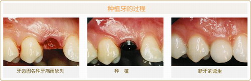 ��ֲ��ʾ��ͼ